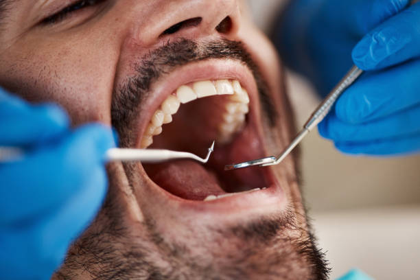 Best Emergency Dental Care for Broken or Chipped Teeth in Port Chester, NY